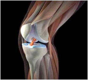 Лечение боли в колене